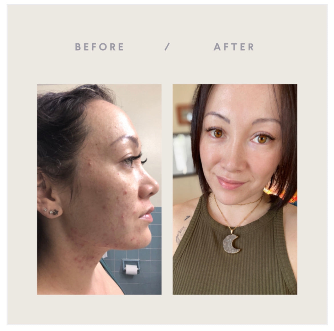 Before and After using Flawless Gel Cleanser from Lather and Soul